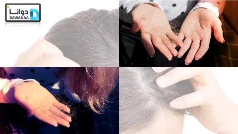 علاج تساقط الشعر عند النساء"تعرف على الخيارات المتاحة لعلاج تساقط الشعر."