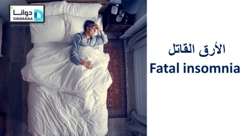 الأرق القاتل Fatal insomnia"هل ممكن أن يؤدي الأرق إلى الموت؟"