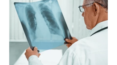 ما هي أضرار وفوائد الأشعة السينية (X-Ray)؟