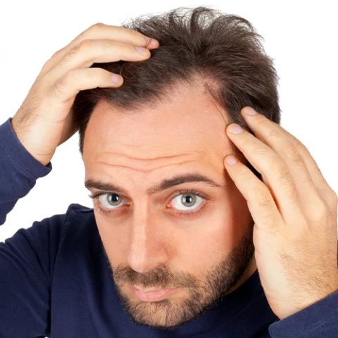 تساقط الشعر للرجال: أسبابه، تشخيصه، ونصائح للعناية بالشعر