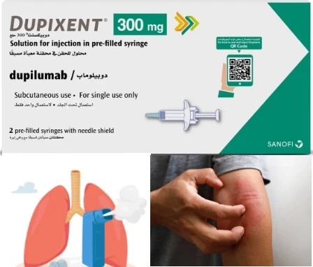 كل ما تريد معرفته عن  دوبيكسنت Dupixant أهم الاستخدامات لدواء دوبيكسنت Dupixent وكذلك الآثار الجانبية